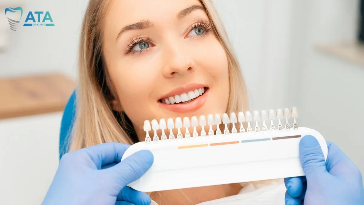 laminate veneers in istanbul turkey