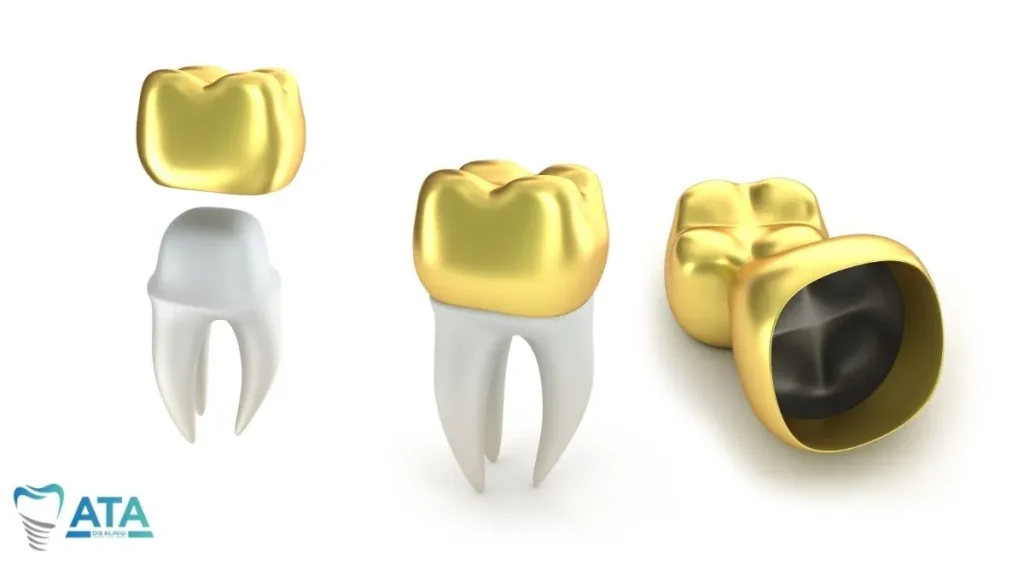 dental crown cost in Turkey