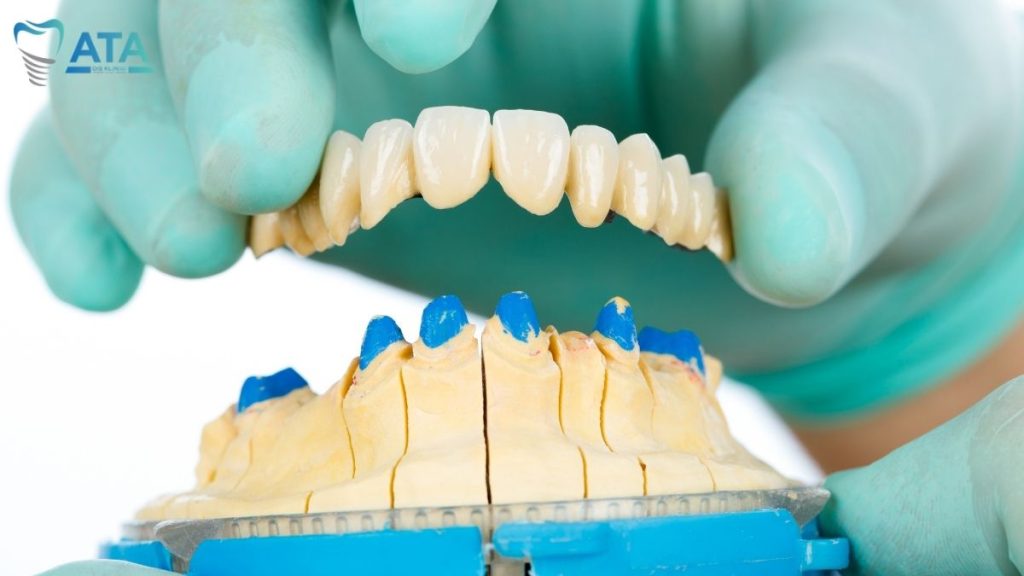 dental crowns in Turkey
