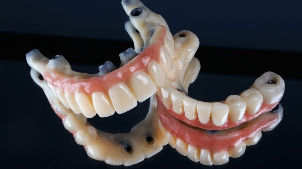 Full Mouth dental implant in Turkey