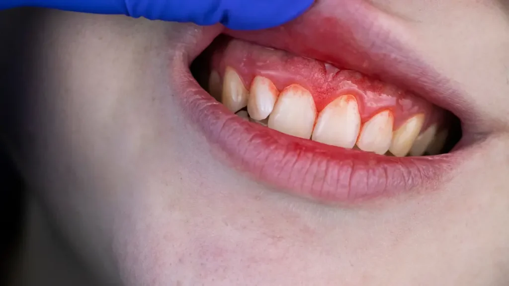 periodontoloji istanbul