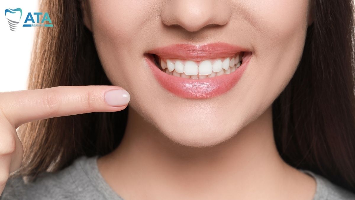 diş eti çekilmesi tedavisi