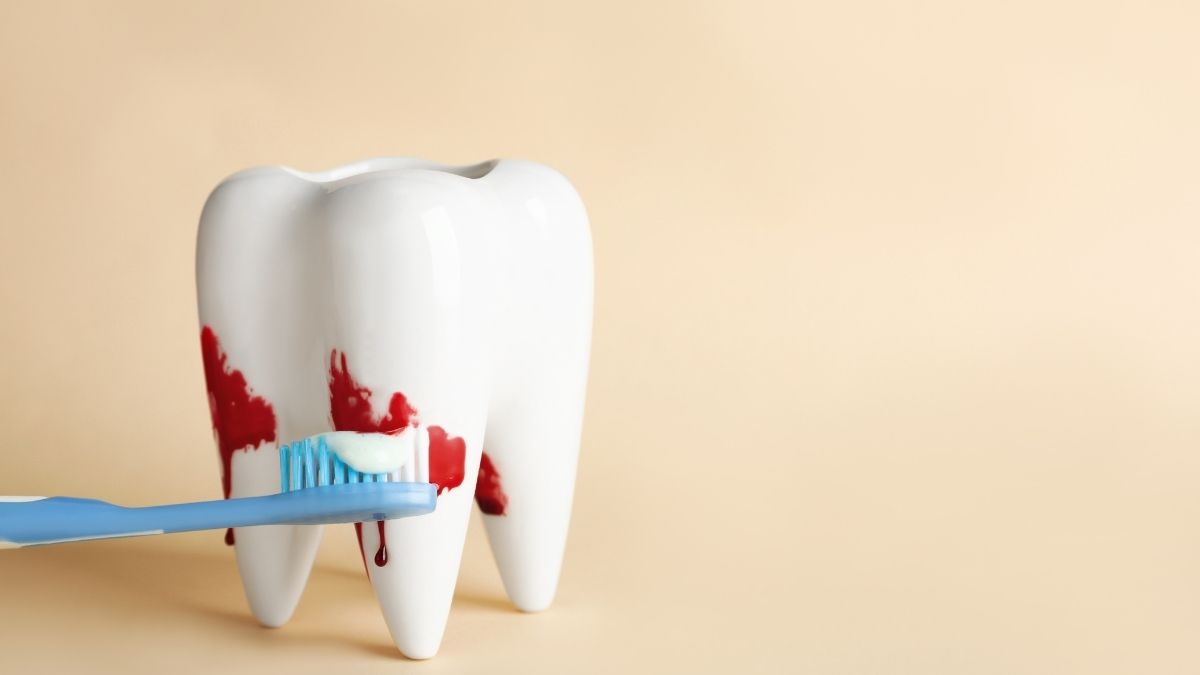 diş eti kanaması nedenleri