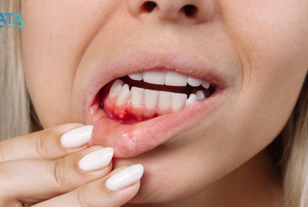 Diş eti hastalıklarına hangi bölüm bakar