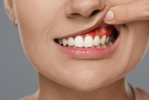 bayrampaşa diş kisti ameliyatı