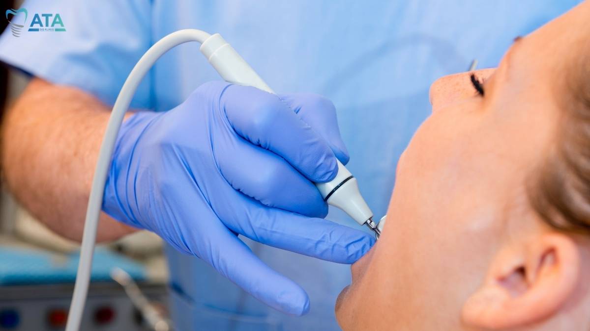 diş taşı neden olur