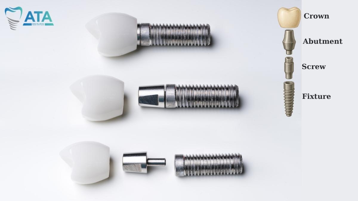 second stage surgery dental implant