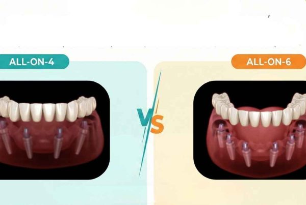 all on 4 vs all on 6