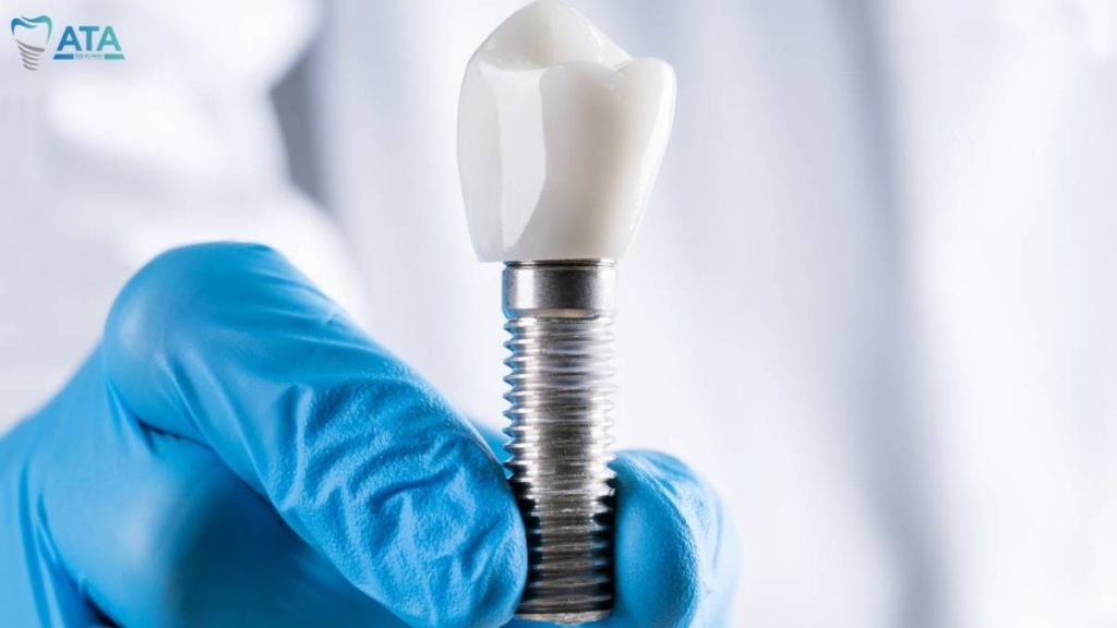 single tooth implant cost turkey