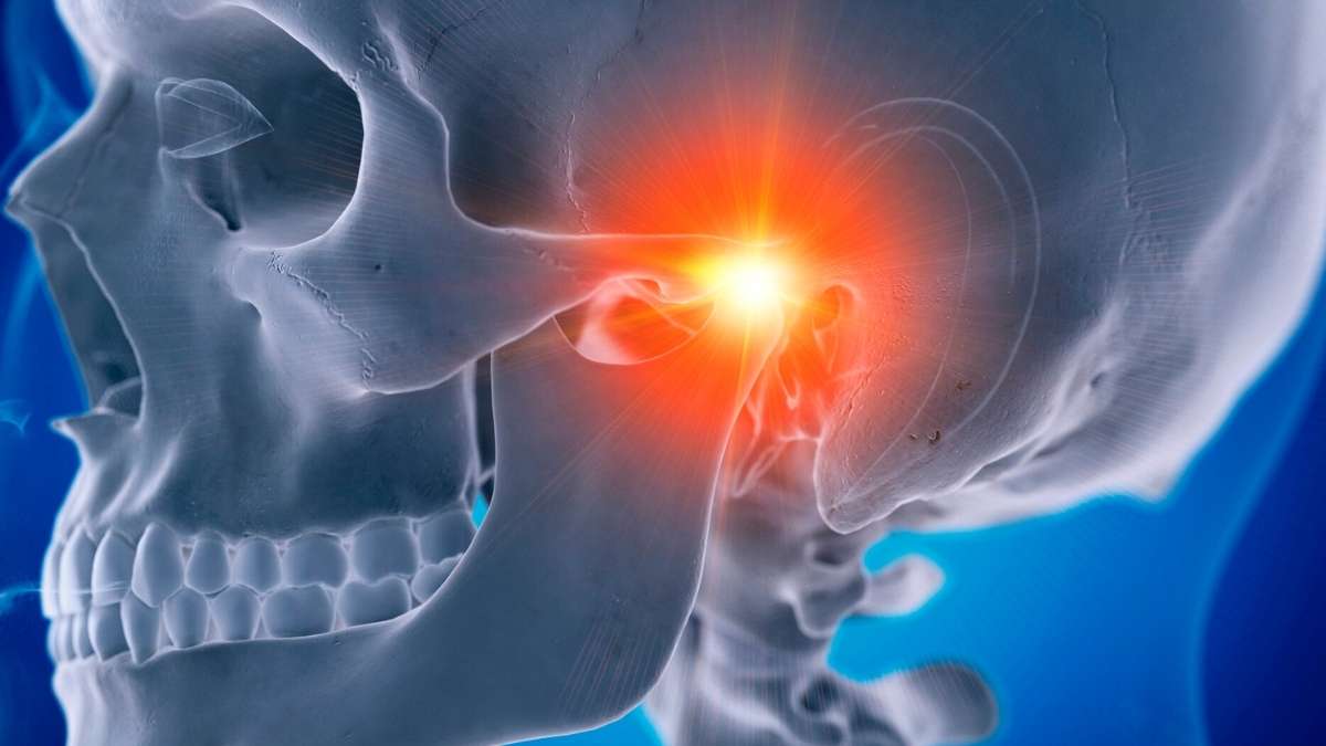 Temporomandibular Eklem